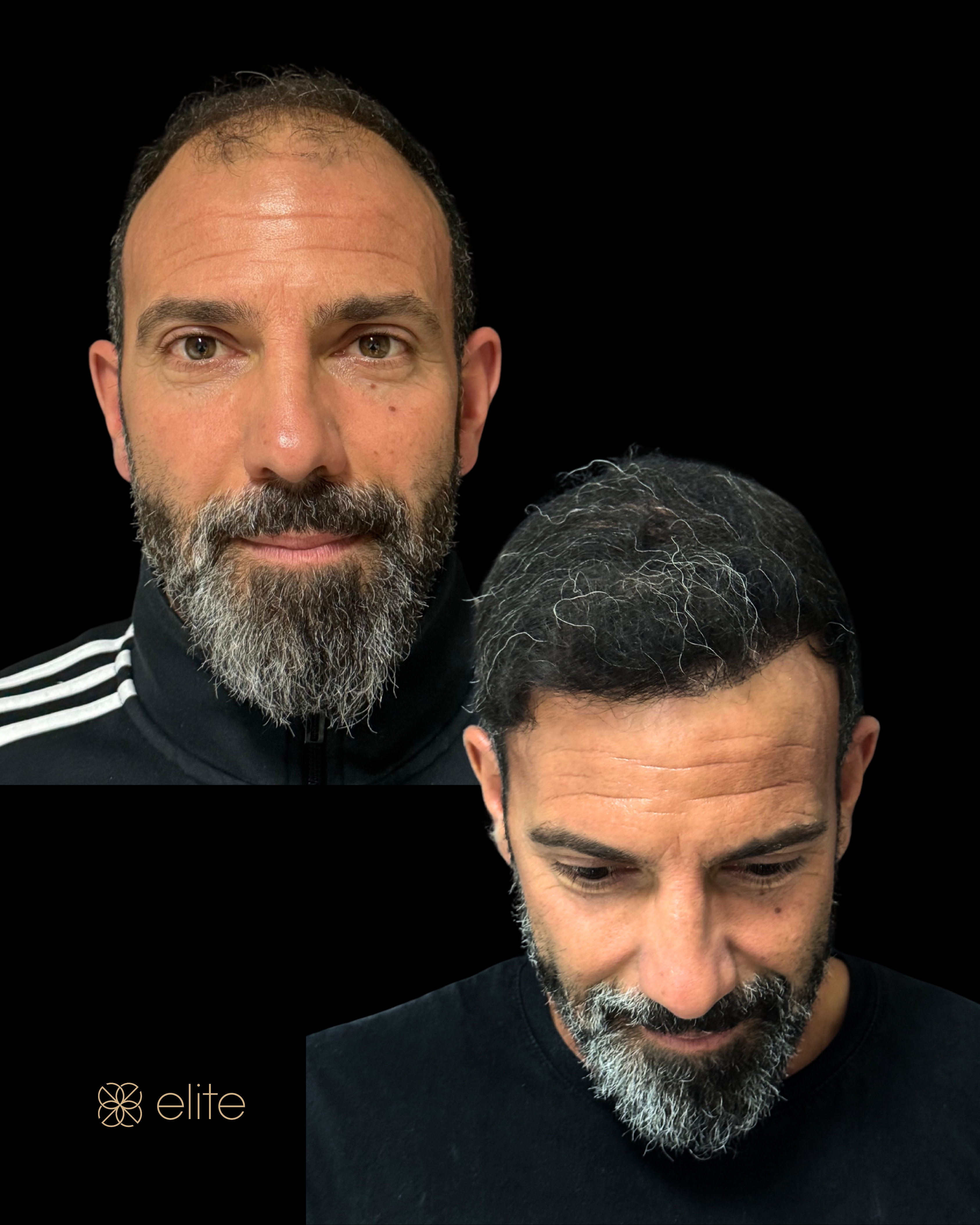 Risultato (foto 4)