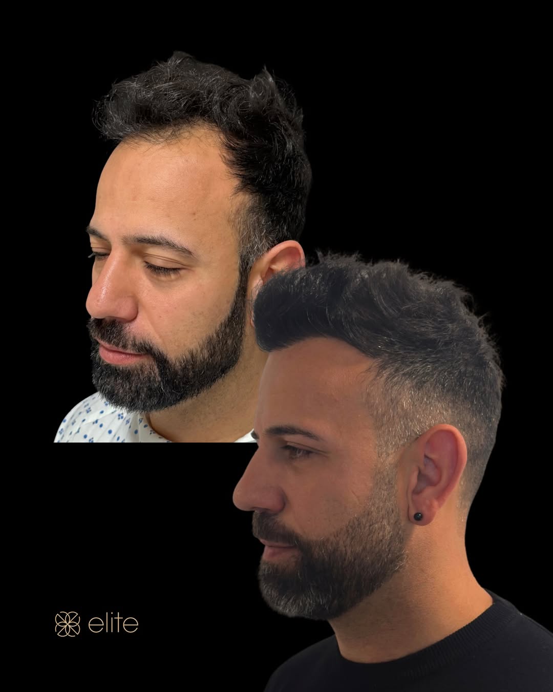 Risultato (foto 12)