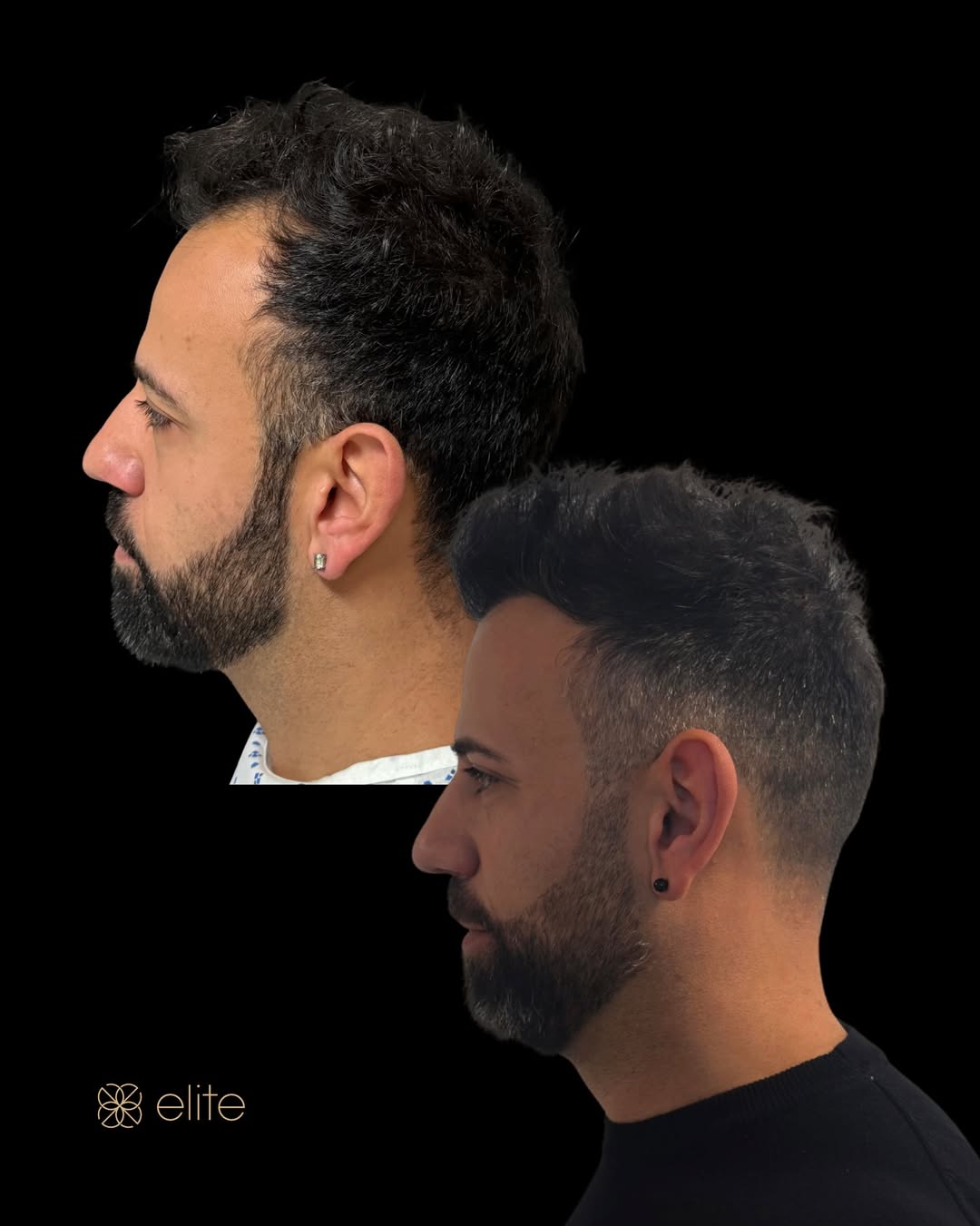 Risultato (foto 13)